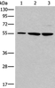 Western blot analysis of 293T and A172 cell lysates  using TRIM27 Polyclonal Antibody at dilution of 1:600