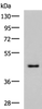 Western blot analysis of TM4 cell lysate  using WDR4 Polyclonal Antibody at dilution of 1:700