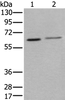 Western blot analysis of Hela and A549 cell lysates  using YY1 Polyclonal Antibody at dilution of 1:400