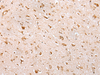 Immunohistochemistry of paraffin-embedded Human brain tissue  using YY1 Polyclonal Antibody at dilution of 1:35(×200)