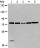 Western blot analysis of Mouse liver tissue Hela cell Human testis tissue Jurkat and HEPG2 cell lysates  using ATF6B Polyclonal Antibody at dilution of 1:300