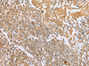 Immunohistochemistry of paraffin-embedded Human tonsil tissue  using NDUFB3 Polyclonal Antibody at dilution of 1:25(×200)