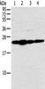 Western blot analysis of Hela cell and human fetal liver tissue A549 and Jurkat cell  using NDUFB9 Polyclonal Antibody at dilution of 1:400