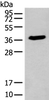 Western blot analysis of HEPG2 cell lysate  using ACBD4 Polyclonal Antibody at dilution of 1:400