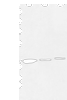 Western blot analysis of 231 cell Human fetal liver and Human fetal brain tissue  using MAT2B Polyclonal Antibody at dilution of 1:500