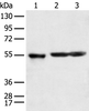 Western blot analysis of Human cerebrum tissue rat brain tissue and Mouse brain tissue  using KCTD16 Polyclonal Antibody at dilution of 1:350