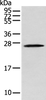 Western blot analysis of Human fetal brain tissue  using TPPP Polyclonal Antibody at dilution of 1:250