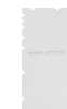 Western blot analysis of Human fetal brain tissue 231 cell  using RAB11A Polyclonal Antibody at dilution of 1:400