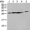 Western blot analysis of 293T cell Human fetal liver tissue A549 and Hepg2 cell  using FKBP7 Polyclonal Antibody at dilution of 1:400