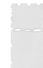 Western blot analysis of Human fetal brain tissue Human cerebrum tissue Mouse brain tissue  using MOB4 Polyclonal Antibody at dilution of 1:400