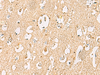 Immunohistochemistry of paraffin-embedded Human brain tissue  using LRRC28 Polyclonal Antibody at dilution of 1:60(×200)