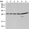 Western blot analysis of 293T A549 and Hela cell  using SFN Polyclonal Antibody at dilution of 1:250