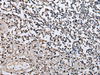 Immunohistochemistry of paraffin-embedded Human tonsil tissue  using ZFP36 Polyclonal Antibody at dilution of 1:40(×200)