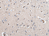 Immunohistochemistry of paraffin-embedded Human brain tissue  using UMPS Polyclonal Antibody at dilution of 1:40(×200)