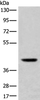 Western blot analysis of Mouse liver tissue lysate  using USP12 Polyclonal Antibody at dilution of 1:700