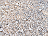Immunohistochemistry of paraffin-embedded Human tonsil tissue  using UTP3 Polyclonal Antibody at dilution of 1:40(×200)