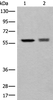 Western blot analysis of EPG2 and Jurkat cell lysates  using ATL3 Polyclonal Antibody at dilution of 1:800