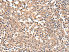 Immunohistochemistry of paraffin-embedded Human tonsil tissue  using ATRIP Polyclonal Antibody at dilution of 1:40(×200)