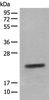 Western blot analysis of Mouse eye tissue lysate  using CRYGS Polyclonal Antibody at dilution of 1:800