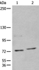 Western blot analysis of 562 and Jurkat cell lysates  using NCAPH Polyclonal Antibody at dilution of 1:450