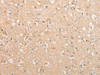 Immunohistochemistry of paraffin-embedded Human brain tissue  using C15orf40 Polyclonal Antibody at dilution of 1:30(×200)