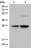 Western blot analysis of HL-60 and HEPG2 cell lysates  using COA7 Polyclonal Antibody at dilution of 1:550
