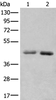 Western blot analysis of A549 and Hela cell lysates  using NADK2 Polyclonal Antibody at dilution of 1:1000
