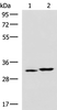 Western blot analysis of 293T cell lysates  using CBR3 Polyclonal Antibody at dilution of 1:800
