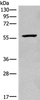Western blot analysis of Mouse heart tissue lysate  using CDADC1 Polyclonal Antibody at dilution of 1:450