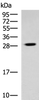 Western blot analysis of Human cerebrum tissue lysate  using TBCB Polyclonal Antibody at dilution of 1:800