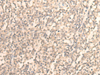 Immunohistochemistry of paraffin-embedded Human tonsil tissue  using DAZ1 Polyclonal Antibody at dilution of 1:55(×200)