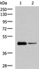 Western blot analysis of HL60 and Jurkat cell lysates  using DDI2 Polyclonal Antibody at dilution of 1:800