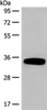Western blot analysis of Human fetal liver tissue lysate  using DHRS1 Polyclonal Antibody at dilution of 1:400