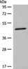 Western blot analysis of K562 cell lysate  using HMBS Polyclonal Antibody at dilution of 1:450