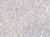 Immunohistochemistry of paraffin-embedded Human tonsil tissue  using CCDC47 Polyclonal Antibody at dilution of 1:25(×200)