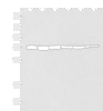 Western blot analysis of 293T cell Human fetal brain tissue Jurkat cell Hela cell Mouse heart tissue lysates  using TCF25 Polyclonal Antibody at dilution of 1:250