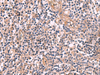 Immunohistochemistry of paraffin-embedded Human tonsil tissue  using MGP Polyclonal Antibody at dilution of 1:75(×200)