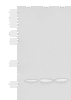 Western blot analysis of Human fetal liver tissue Hela cell HEPG2 cell lysates  using ATP5L Polyclonal Antibody at dilution of 1:500