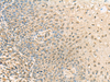Immunohistochemistry of paraffin-embedded Human tonsil tissue  using PPCDC Polyclonal Antibody at dilution of 1:55(×200)