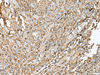 Immunohistochemistry of paraffin-embedded Human tonsil tissue  using HLA-DPB1 Polyclonal Antibody at dilution of 1:45(×200)