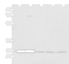 Western blot analysis of Human cerebella tissue Human cerebrum tissue Human skin tissue NIH/3T3 cell SKOV3 cell lysates  using OVOL2 Polyclonal Antibody at dilution of 1:350