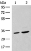 Western blot analysis of Hela cell and Human fetal liver tissue lysates  using SCGN Polyclonal Antibody at dilution of 1:600