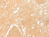 Immunohistochemistry of paraffin-embedded Human brain tissue  using STK32C Polyclonal Antibody at dilution of 1:40(×200)