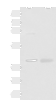 Western blot analysis of Mouse kidney tissue and Human fetal brain tissue lysates  using ADH5 Polyclonal Antibody at dilution of 1:500