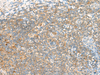 Immunohistochemistry of paraffin-embedded Human tonsil tissue  using TTLL1 Polyclonal Antibody at dilution of 1:60(×200)