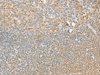 Immunohistochemistry of paraffin-embedded Human tonsil tissue  using PSMD12 Polyclonal Antibody at dilution of 1:40(×200)