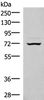 Western blot analysis of 293T cell lysate  using EIF2AK1 Polyclonal Antibody at dilution of 1:350