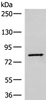 Western blot analysis of Human hepatocellular carcinoma tissue lysate  using SLC26A3 Polyclonal Antibody at dilution of 1:250
