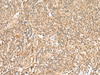 Immunohistochemistry of paraffin-embedded Human tonsil tissue  using GTF2A2 Polyclonal Antibody at dilution of 1:30(×200)