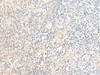 Immunohistochemistry of paraffin-embedded Human tonsil tissue  using SNRPD1 Polyclonal Antibody at dilution of 1:70(×200)